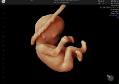 Ecografie 3D / 4D - Ginecologie Botosani - 4Life Women's Health Center