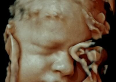 Ecografie 3D / 4D - Ginecologie Botosani - 4Life Women's Health Center